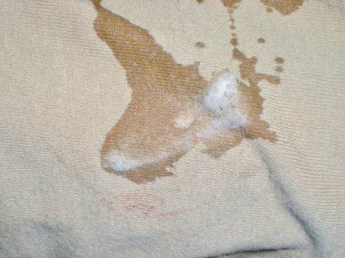 Removing Blood Stains From Laundry Fabric ~ Texas Homesteader