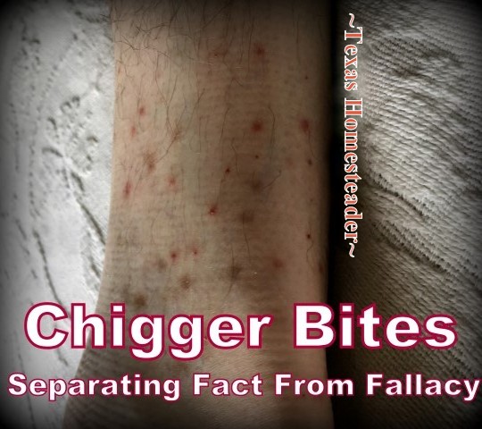 Chiggers - we've all dealt with them, right? Oh the misery of their itching which can last for weeks. I've heard some crazy cures, most of them WRONG! #TexasHomesteader